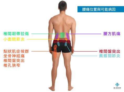 腰氣結|腰痠背痛，好不了？按這張圖找出正確「激痛點」，按。